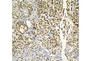 IHC analysis of PHF21A using anti-PHF21A antibody (ABIN6719353).