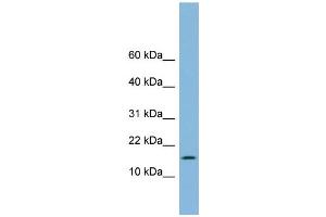 WB Suggested Anti-UBE2L6 Antibody Titration: 0. (UBE2L6 Antikörper  (Middle Region))