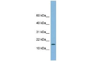 WB Suggested Anti-UBE2L6 Antibody Titration: 0.