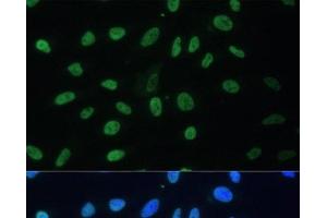 Immunofluorescence analysis of U-2 OS cells using HNRNPD Polyclonal Antibody at dilution of 1:100. (HNRNPD/AUF1 Antikörper)