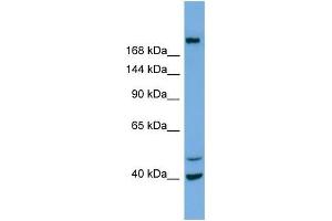 Western Blotting (WB) image for anti-Inositol Polyphosphate-5-Phosphatase F (INPP5F) (N-Term) antibody (ABIN2786063) (INPP5F Antikörper  (N-Term))