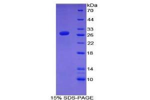 SDS-PAGE analysis of Mouse ATF7 Protein. (AFT7 Protein)