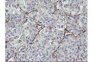 Immunohistochemistry (IHC) image for anti-Mesoderm Induction Early Response 1, Family Member 2 (MIER2) (AA 1-296) antibody (ABIN1490703) (MIER2 Antikörper  (AA 1-296))