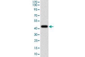 Western blot analysis of human FTL (AA: 1-157) recombinant protein (Expected MW is 45.