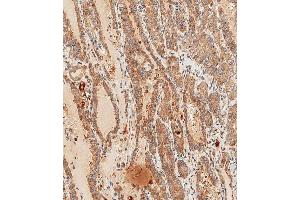 Immunohistochemistry (Paraffin-embedded Sections) (IHC (p)) image for anti-Wingless-Type MMTV Integration Site Family, Member 5A (WNT5A) (AA 185-213) antibody (ABIN651869)