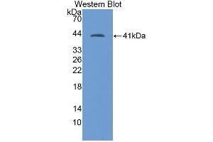 Western blot analysis of the recombinant protein. (SLC9A3R2 Antikörper  (AA 56-326))