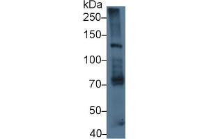 Detection of LAMb3 in Mouse Lung lysate using Polyclonal Antibody to Laminin Beta 3 (LAMb3) (Laminin beta 3 Antikörper  (AA 595-778))