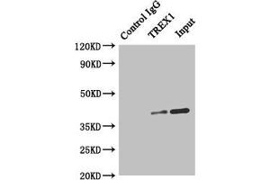 Immunoprecipitating TREX1 in Hela whole cell lysate Lane 1: Rabbit control IgG instead of (1 μg) instead of ABIN7172071 in Hela whole cell lysate. (TREX1 Antikörper  (AA 1-270))