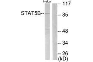 Western blot analysis of extracts from HeLa, using STAT5B (Ab-731) Antibody.