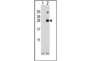 Western blot analysis of RNF11 (arrow) using RNF11 Antibody (Center) Cat. (RNF11 Antikörper  (Middle Region))