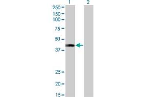 Western Blot analysis of AFF4 expression in transfected 293T cell line by AFF4 monoclonal antibody (M01), clone 2E12.