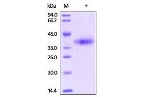 Biotinylated Human Mesothelin (aa 296-580) on SDS-PAGE under reducing (R) condition. (Mesothelin Protein (MSLN) (AA 296-580) (His tag,Biotin))