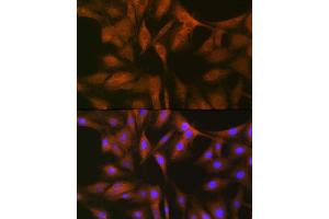 Immunofluorescence analysis of C6 cells using FXR1 Rabbit mAb (ABIN7267257) at dilution of 1:100 (40x lens). (FXR1 Antikörper)
