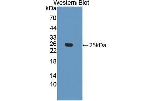 Western blot analysis of the recombinant protein. (Ephrin A5 Antikörper  (AA 21-203))