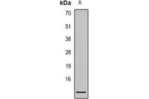 Western blot analysis of S100-A1 expression in Hela (A) whole cell lysates. (S100A1 Antikörper)