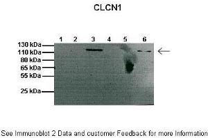 Lanes:   1: 20ug mouse muscle membrane fraction, 2: Empty, 3: 20ug mouse brain membrane fraction, 4: Empty, 5: 20ug mouse muscle cytosolic fraction, 6: 20ug mouse brain cytosolic fraction  Primary Antibody Dilution:   1:1000  Secondary Antibody:   Anti-rabbit HRP  Secondary Antibody Dilution:   1:2000  Gene Name:   Clcn1  Submitted by:   Anonymous (CLCN1 Antikörper  (C-Term))