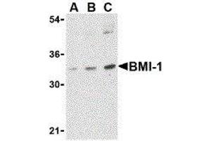 Western Blotting (WB) image for anti-BMI1 Polycomb Ring Finger Oncogene (BMI1) (Center) antibody (ABIN2477677) (BMI1 Antikörper  (Center))