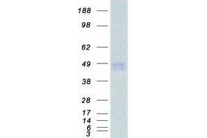 Western Blotting (WB) image for Interferon gamma Receptor 2 (Interferon gamma Transducer 1) (IFNGR2) protein (Myc-DYKDDDDK Tag) (ABIN2723350)