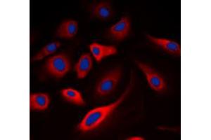 Immunofluorescent analysis of Calmodulin (pT80/S82) staining in A549 cells. (Calmodulin 1 Antikörper  (pSer80, pSer82))