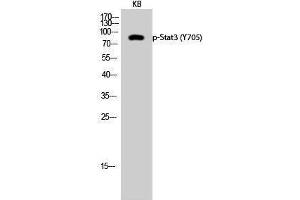 Western Blotting (WB) image for anti-Signal Transducer and Activator of Transcription 3 (Acute-Phase Response Factor) (STAT3) (pTyr705) antibody (ABIN3179505) (STAT3 Antikörper  (pTyr705))