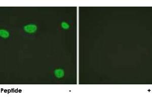 Immunofluorescence analysis of HeLa cells, using VDR polyclonal antibody . (Vitamin D Receptor Antikörper  (Ser208))