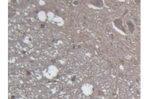 IHC-P analysis of Rat Spinal cord Tissue, with DAB staining. (GLRa2 Antikörper  (AA 28-253))