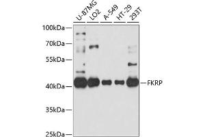 Western blot analysis of extracts of various cell lines, using FKRP antibody (ABIN6132005, ABIN6140666, ABIN6140667 and ABIN6214350) at 1:1000 dilution. (FKRP Antikörper  (AA 30-220))