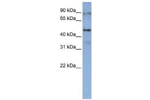 WB Suggested Anti-DAZAP1  Antibody Titration: 0. (DAZAP1 Antikörper  (Middle Region))
