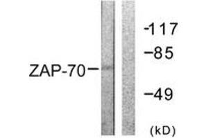 Western blot analysis of extracts from 293 cells, treated with PMA 125ng/ml 30', using ZAP-70 (Ab-292) Antibody. (ZAP70 Antikörper  (AA 258-307))