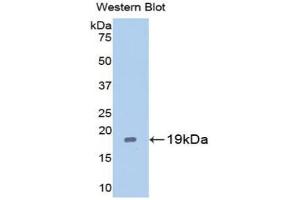 Western blot analysis of the recombinant protein. (Caspase 2 Antikörper  (AA 170-333))