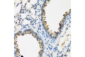 Immunohistochemistry of paraffin-embedded mouse lung using CYP2F1 antibody. (CYP2F1 Antikörper  (AA 100-290))