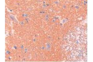 IHC-P analysis of Rat Spinal Cord Tissue, with DAB staining. (SPTAN1 Antikörper  (AA 2071-2269))
