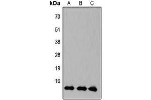 Western blot analysis of KLF10/11 expression in HEK293T (A), Raw264. (KLF10/11 Antikörper  (C-Term))