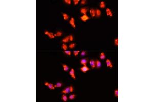 Immunofluorescence analysis of HeLa cells using HOX antibody (ABIN3017106, ABIN3017107, ABIN1680330 and ABIN6219956) at dilution of 1:100 (40x lens). (Homeobox A11 Antikörper  (AA 1-180))
