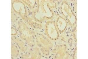 Immunohistochemistry (IHC) image for anti-Methylmalonic Aciduria (Cobalamin Deficiency) CblC Type, with Homocystinuria (MMACHC) (AA 63-282) antibody (ABIN7159655)