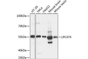 Western blot analysis of extracts of various cell lines, using LPC antibody (ABIN7268338) at 1:3000 dilution. (LPCAT4 Antikörper  (AA 345-524))