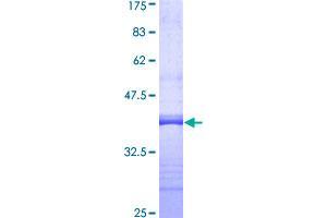 Image no. 1 for Interferon alpha/beta Receptor 1 (IFNAR1) (AA 28-127) protein (GST tag) (ABIN1307488)