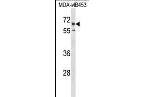 CATSPER2 Antibody (C-term) (ABIN1537377 and ABIN2850383) western blot analysis in MDA-M cell line lysates (35 μg/lane). (CATSPER2 Antikörper  (C-Term))