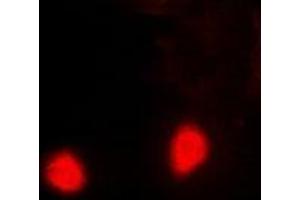 Immunofluorescent analysis of PSMD10 staining in Hela cells. (PSMD10 Antikörper)