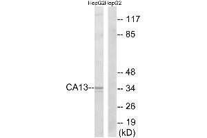 Western blot analysis of extracts from HepG2 cells, using CA13 antibody. (CA13 Antikörper)