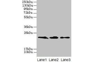 Western blot All lanes: CLDN20 antibody at 4 μg/mL Lane 1: A549 whole cell lysate Lane 2: HepG2 whole cell lysate Lane 3: PC-3 whole cell lysate Secondary Goat polyclonal to rabbit IgG at 1/10000 dilution Predicted band size: 24 kDa Observed band size: 24 kDa (Claudin 2 Antikörper  (AA 29-81))
