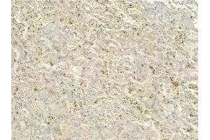 ABIN6258660 and ABIN6274798 at 1/100 staining human normal lung tissue by IHC-P. (ACSS1 Antikörper  (C-Term))