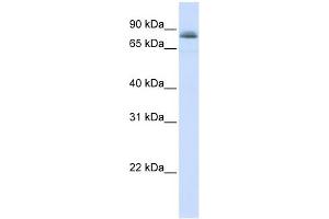 WB Suggested Anti-STAT5A Antibody Titration:  0. (STAT5A Antikörper  (C-Term))