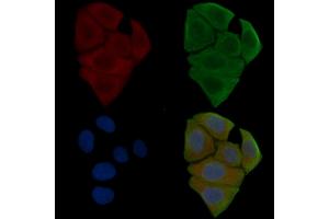 ABIN6255732 and ABIN6267570 staining Hela cells(30 min of UV treatment) by IF/ICC. (ADAM17 Antikörper  (pThr735))