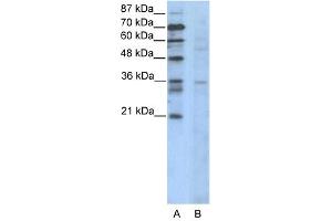 CCNB3 antibody (20R-1100) used at 0. (Cyclin B3 Antikörper  (N-Term))