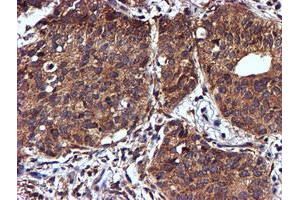 Image no. 9 for anti-NADH Dehydrogenase (Ubiquinone) Complex I, Assembly Factor 7 (NDUFAF7) antibody (ABIN1499667) (NDUFAF7 Antikörper)