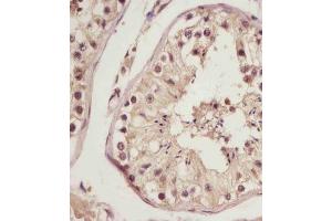 (ABIN6243401 and ABIN6578787) staining NSFL1C in human testis tissue sections by Immunohistochemistry (IHC-P - paraformaldehyde-fixed, paraffin-embedded sections). (NSFL1C Antikörper  (AA 37-71))