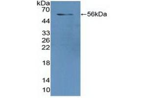 Detection of Recombinant GR, Human using Polyclonal Antibody to Glutathione Reductase (GR) (Glutathione Reductase Antikörper  (AA 44-522))