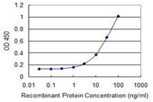 Detection limit for recombinant GST tagged SGOL1 is 0. (Shugoshin Antikörper  (AA 1-292))