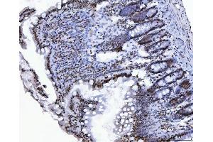 IHC analysis of CTBP2 using anti-CTBP2 antibody (ABIN7601326). (CTBP2 Antikörper  (AA 321-445))